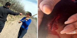 #LadyAzadon no es funcionaria; fracturó cráneo a joven