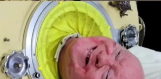 Murió Paul Alexander, hombre que vivió en un pulmón de acero por 70 años